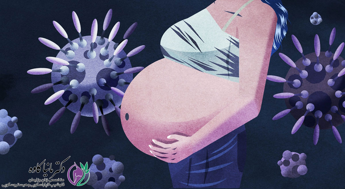 کرونا ویروس و بارداری