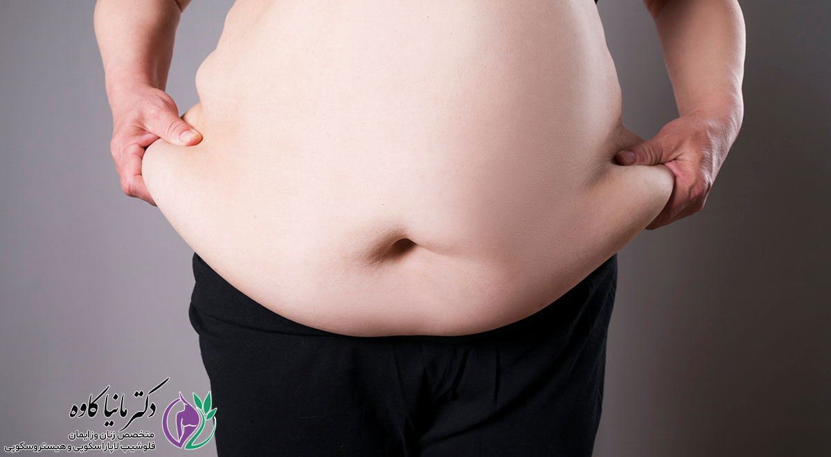چاقی در بارداری و عوارض آن